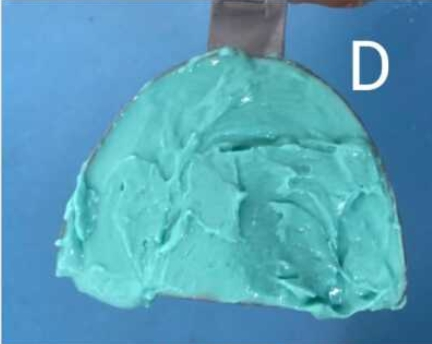 Alginate-based dental impression material that can be used for replicating fingerprints