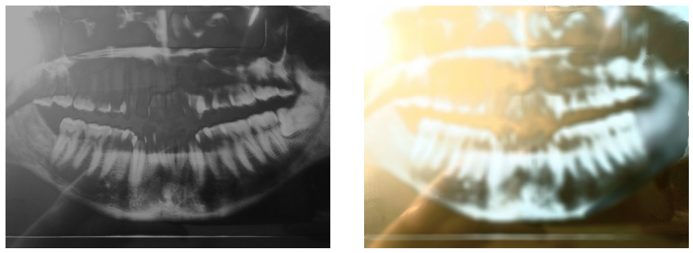 Authentic (left) and tampered (right) dental photos