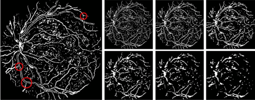 Bifurcation points identified in retinal vessels for retinal recognition and liveness detection
