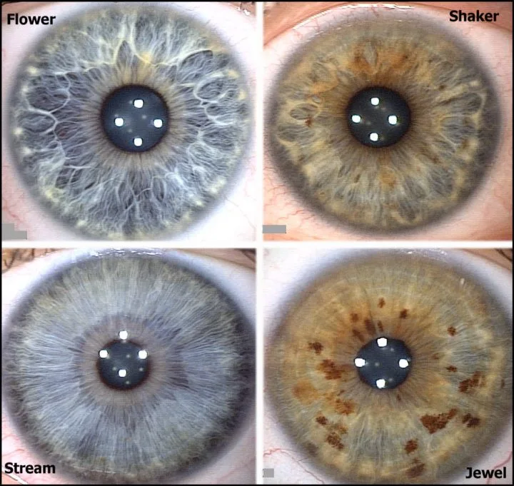Rayid’s model identified 4 constitutional patterns of a human iris