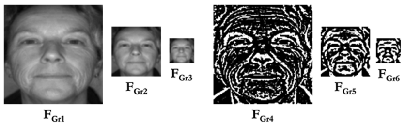 Facial detection algorithm using first level facial granules for plastic surgery detection