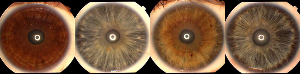 iris patterns in TELKOMNIKA database used for anti-spoofing and liveness detection training