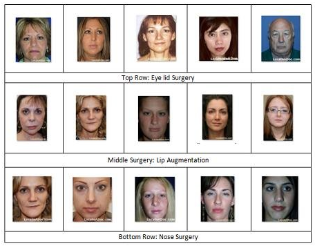 Images of people with different types of plastic surgery from Plastic Surgery Database (PSD)