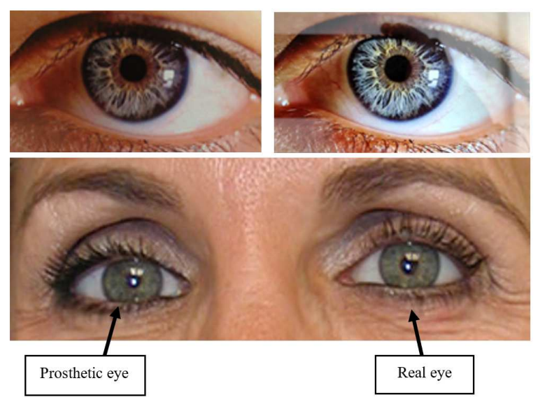 Prosthetic eye used in a spoofing attack vs real human eye